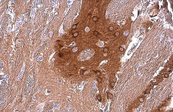 PYK2 Antibody in Immunohistochemistry (Paraffin) (IHC (P))