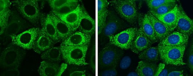 AGR2 Antibody in Immunocytochemistry (ICC/IF)