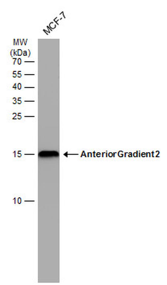 AGR2 Antibody in Western Blot (WB)