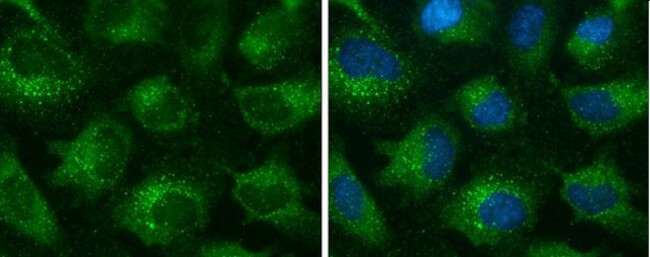 EEA1 Antibody in Immunocytochemistry (ICC/IF)