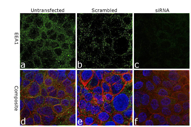 EEA1 Antibody in Immunocytochemistry (ICC/IF)