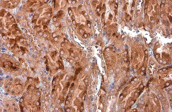 EEA1 Antibody in Immunohistochemistry (Paraffin) (IHC (P))