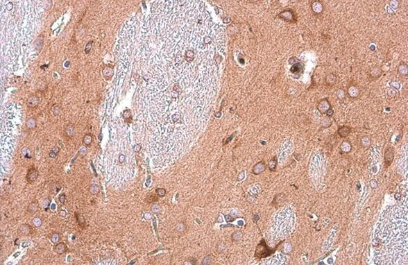 EEA1 Antibody in Immunohistochemistry (Paraffin) (IHC (P))