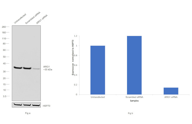 Arginase 1 Antibody