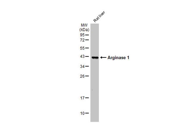 Arginase 1 Antibody in Western Blot (WB)