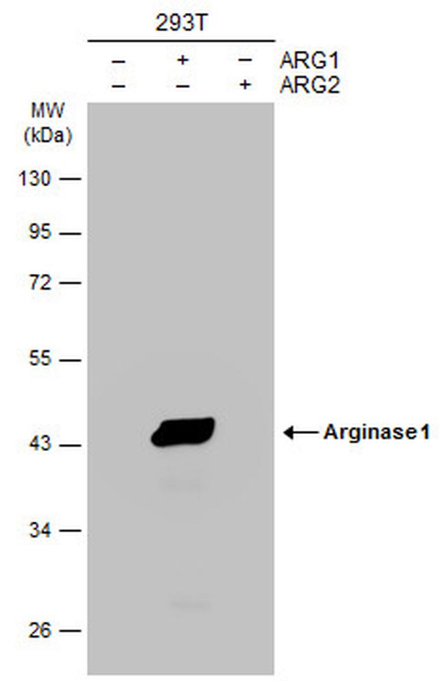 Arginase 1 Antibody in Western Blot (WB)