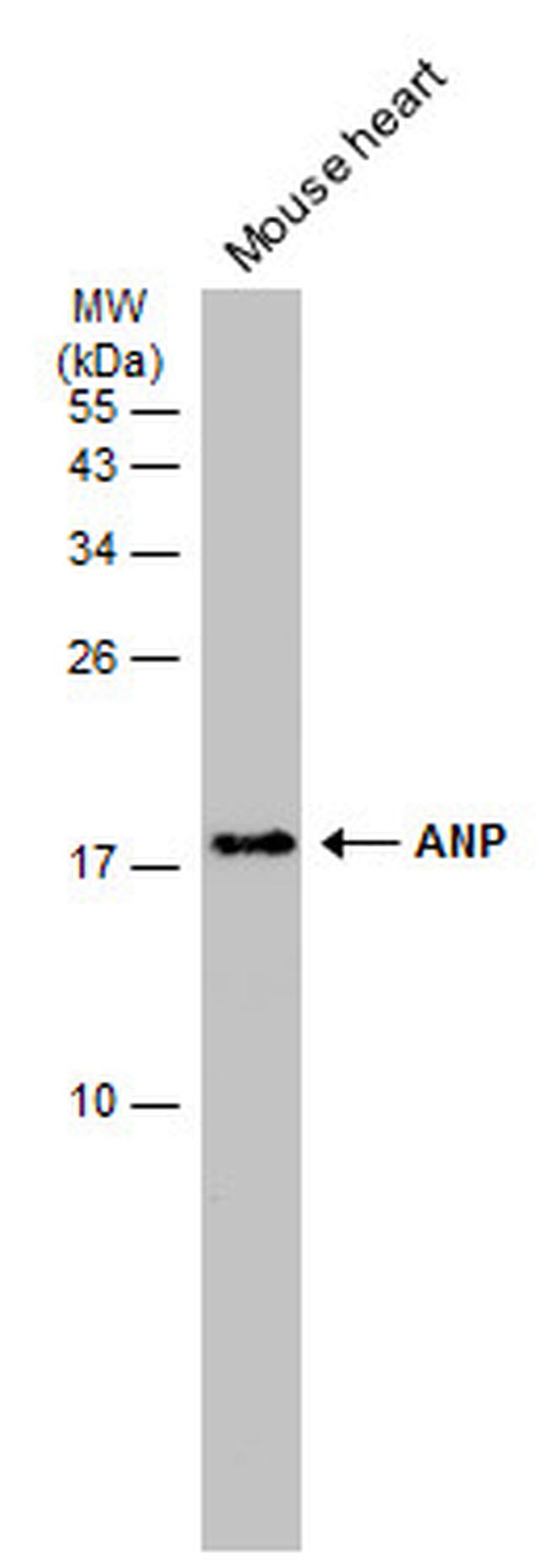 ANP Antibody in Western Blot (WB)