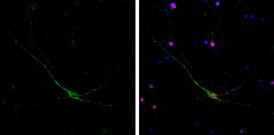 NF-H Antibody in Immunocytochemistry (ICC/IF)