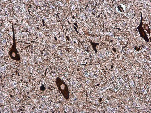 NF-H Antibody in Immunohistochemistry (Paraffin) (IHC (P))