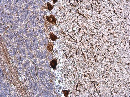 NF-H Antibody in Immunohistochemistry (Paraffin) (IHC (P))