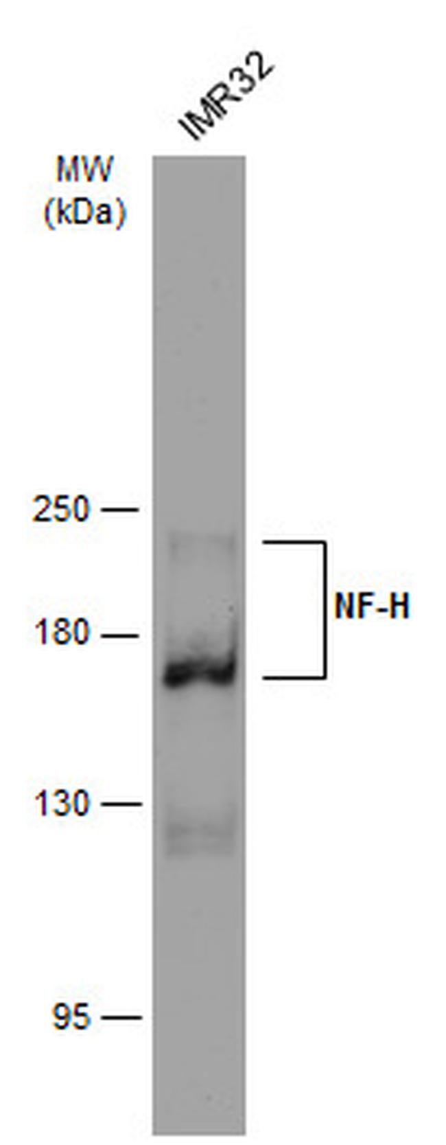 NF-H Antibody in Western Blot (WB)