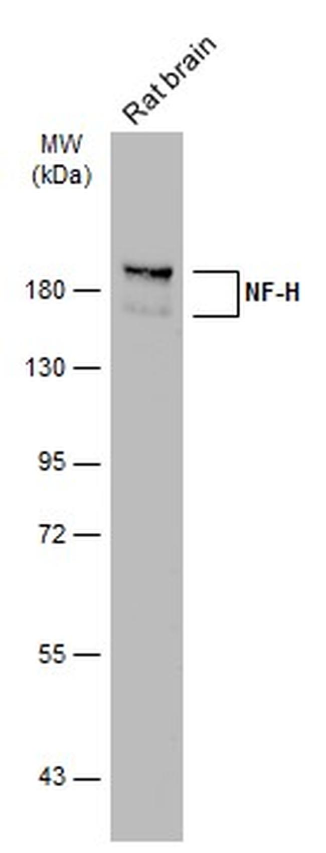 NF-H Antibody in Western Blot (WB)