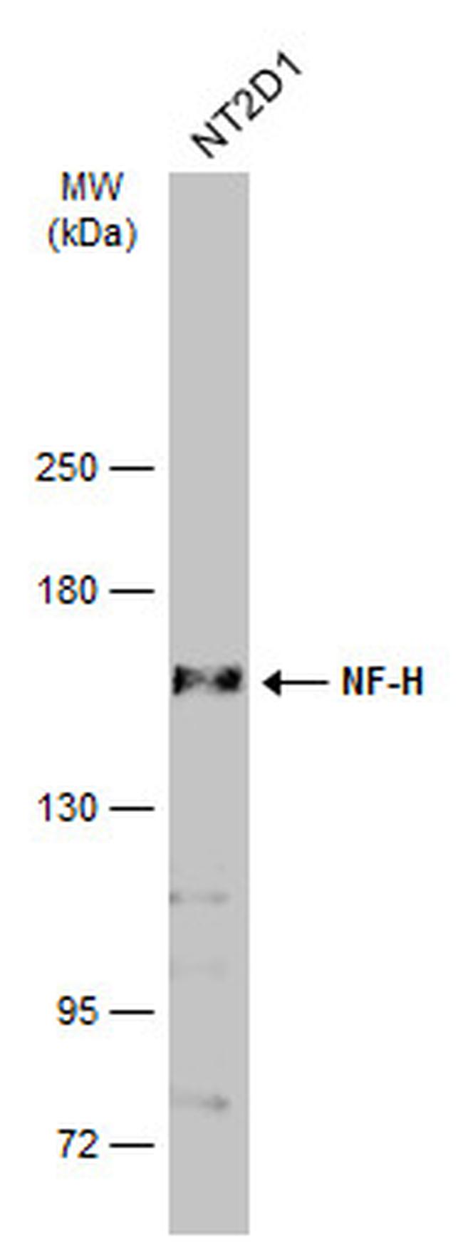 NF-H Antibody in Western Blot (WB)