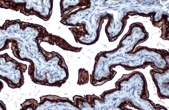 Cytokeratin 5 Antibody in Immunohistochemistry (Paraffin) (IHC (P))