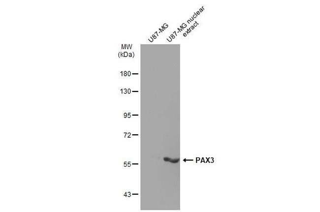 PAX3 Antibody in Western Blot (WB)