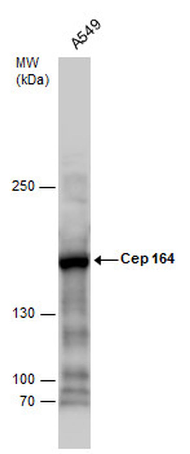 CEP164 Antibody in Western Blot (WB)