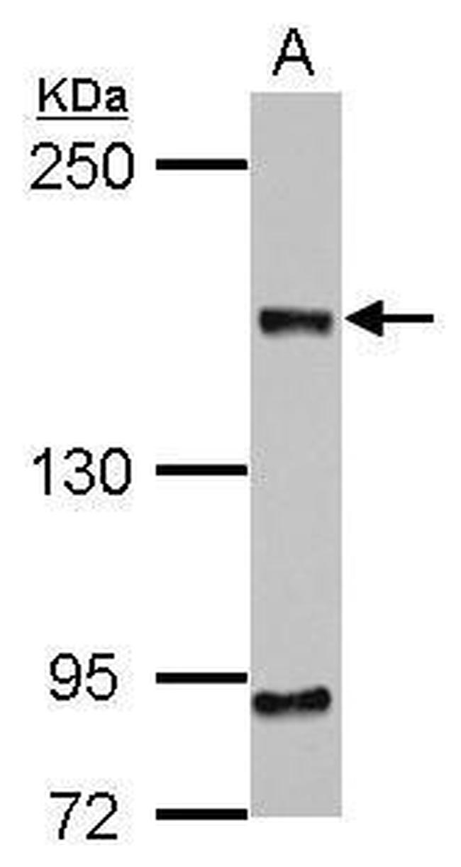 CEP164 Antibody in Western Blot (WB)