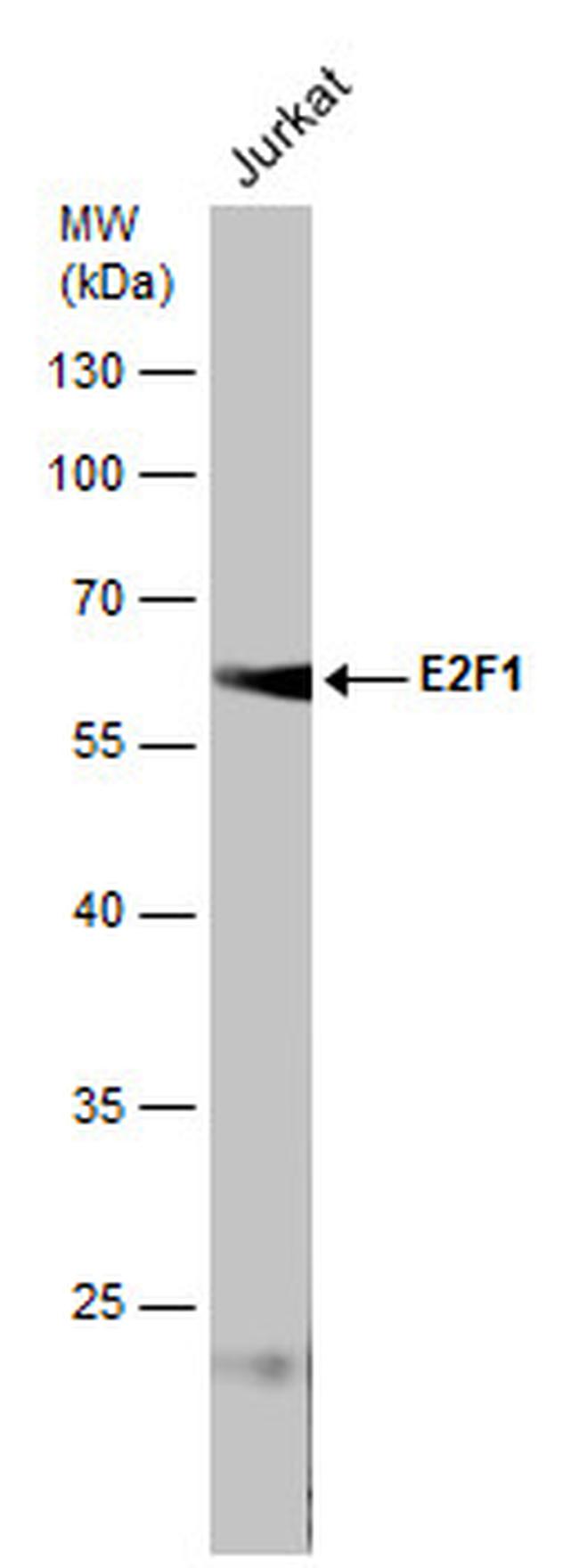 E2F1 Antibody in Western Blot (WB)