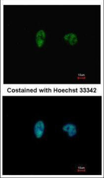 CHK2 Antibody in Immunocytochemistry (ICC/IF)