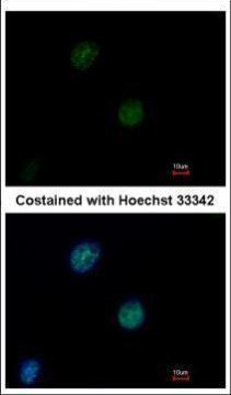 ATM Antibody in Immunocytochemistry (ICC/IF)