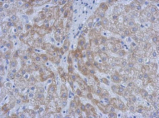 ATM Antibody in Immunohistochemistry (Paraffin) (IHC (P))