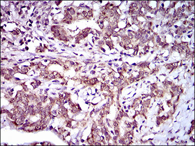 ABCG5 Antibody in Immunohistochemistry (Paraffin) (IHC (P))