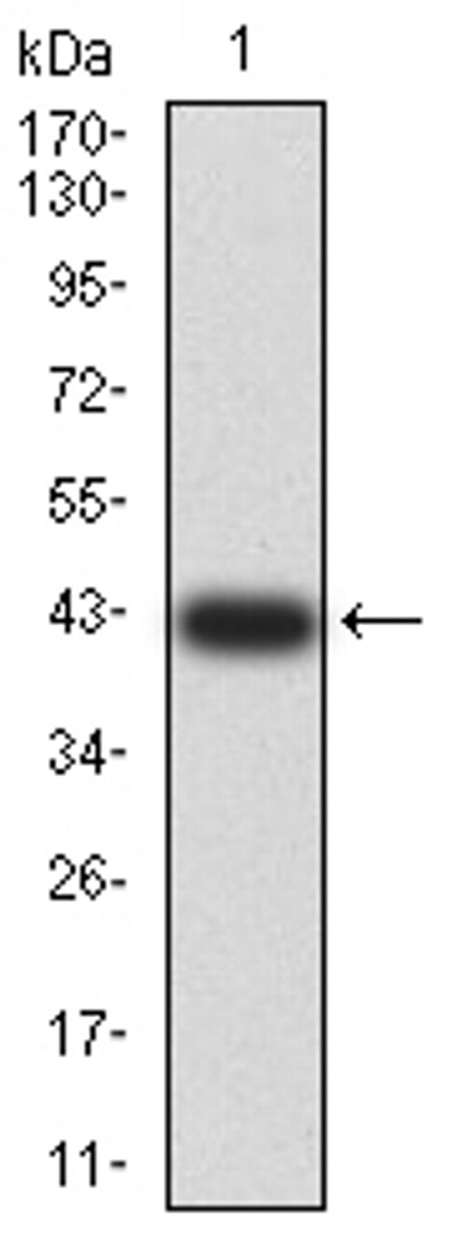 ADAR Antibody in Western Blot (WB)