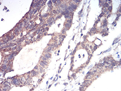 ALDH6A1 Antibody in Immunohistochemistry (Paraffin) (IHC (P))