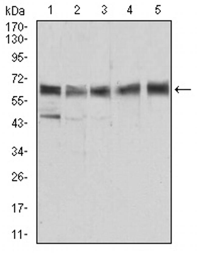 ALDH6A1 Antibody in Western Blot (WB)