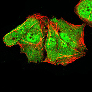 ALDH6A1 Antibody in Immunocytochemistry (ICC/IF)