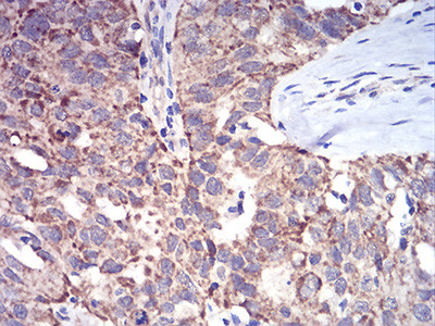 ALDH6A1 Antibody in Immunohistochemistry (Paraffin) (IHC (P))