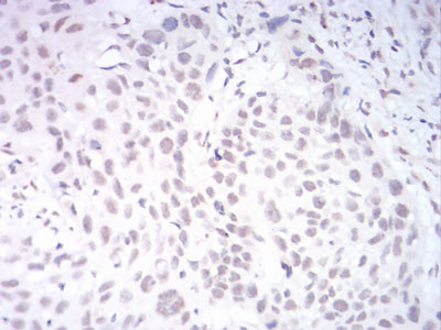 KDM1B Antibody in Immunohistochemistry (Paraffin) (IHC (P))