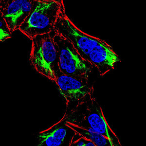 ATF3 Antibody in Immunocytochemistry (ICC/IF)