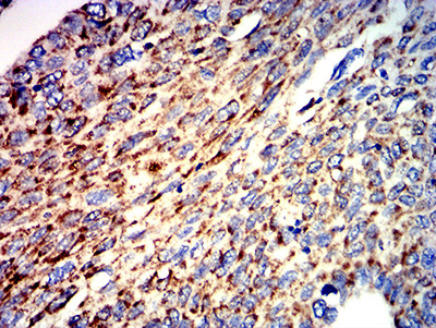 ATPIF1 Antibody in Immunohistochemistry (Paraffin) (IHC (P))