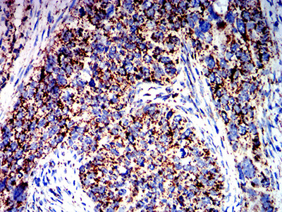 ATPIF1 Antibody in Immunohistochemistry (Paraffin) (IHC (P))