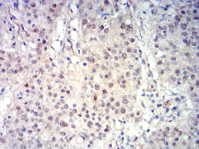 BCL11B Antibody in Immunohistochemistry (Paraffin) (IHC (P))