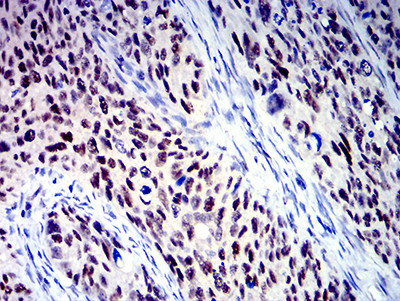 BCL9L Antibody in Immunohistochemistry (Paraffin) (IHC (P))