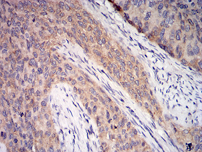 C1QA Antibody in Immunohistochemistry (Paraffin) (IHC (P))