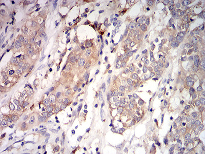 C1QA Antibody in Immunohistochemistry (Paraffin) (IHC (P))