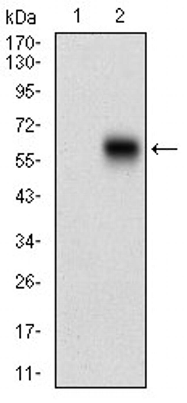 CaMKII gamma Antibody in Western Blot (WB)