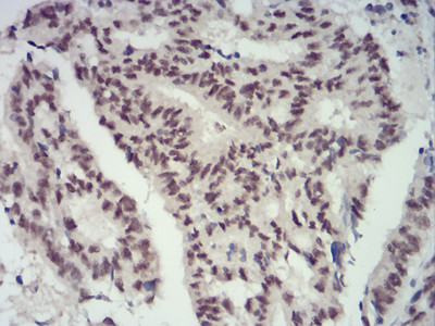 CBX4 Antibody in Immunohistochemistry (Paraffin) (IHC (P))