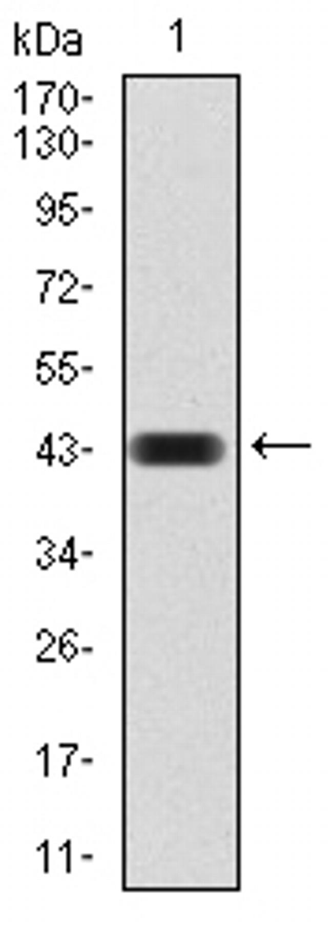 CBX4 Antibody in Western Blot (WB)