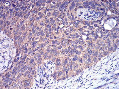 CFHR5 Antibody in Immunohistochemistry (Paraffin) (IHC (P))