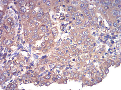 CFHR5 Antibody in Immunohistochemistry (Paraffin) (IHC (P))