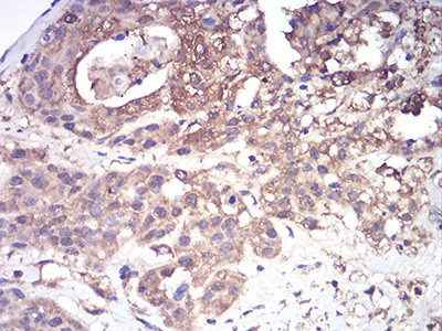 CFHR5 Antibody in Immunohistochemistry (Paraffin) (IHC (P))