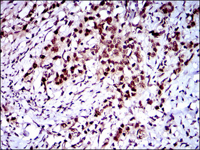 FLIP Antibody in Immunohistochemistry (Paraffin) (IHC (P))