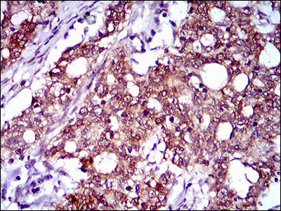 FLIP Antibody in Immunohistochemistry (Paraffin) (IHC (P))