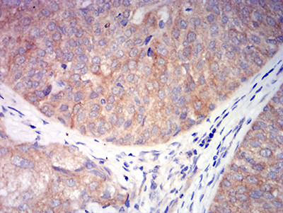 CHRNA6 Antibody in Immunohistochemistry (Paraffin) (IHC (P))