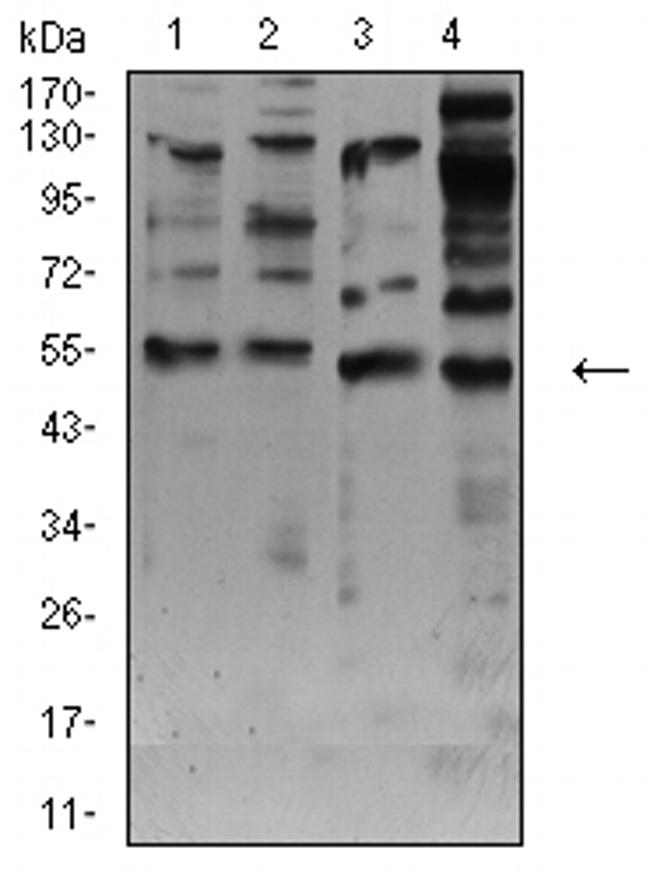 CHRNA7 Antibody in Western Blot (WB)