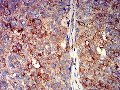 CHRNA7 Antibody in Immunohistochemistry (Paraffin) (IHC (P))